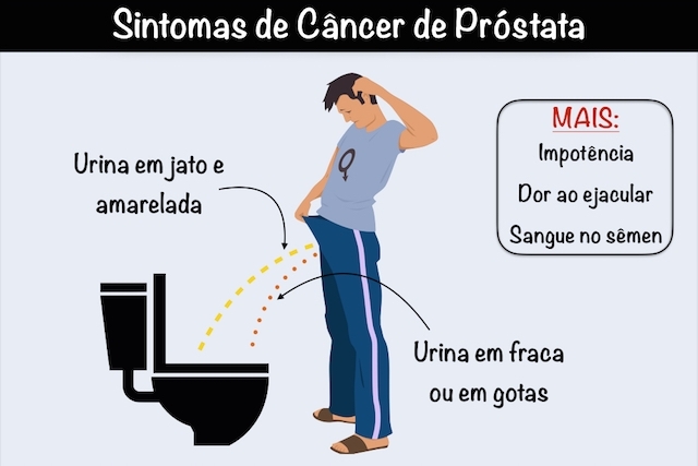 sintomas de cancer de prostata 16952 l